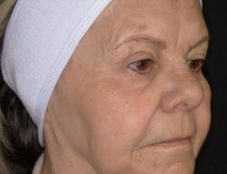 Total Skin | ZO Skin Health