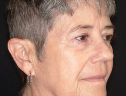 Total Skin | ZO Skin Health