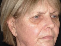 Total Skin | ZO Skin Health