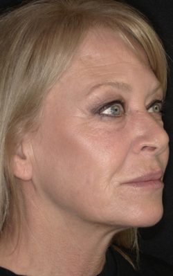 Total Skin | Facial Balancing and ZO Skin Health