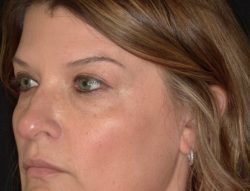 Total Skin | ZO Skin Health