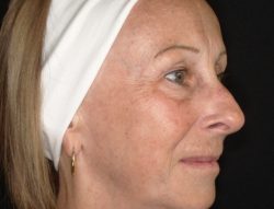 Total Skin | ZO Skin Health