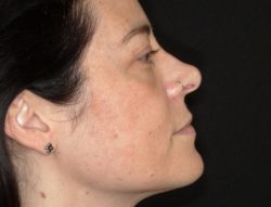 Total Skin | ZO Skin Health